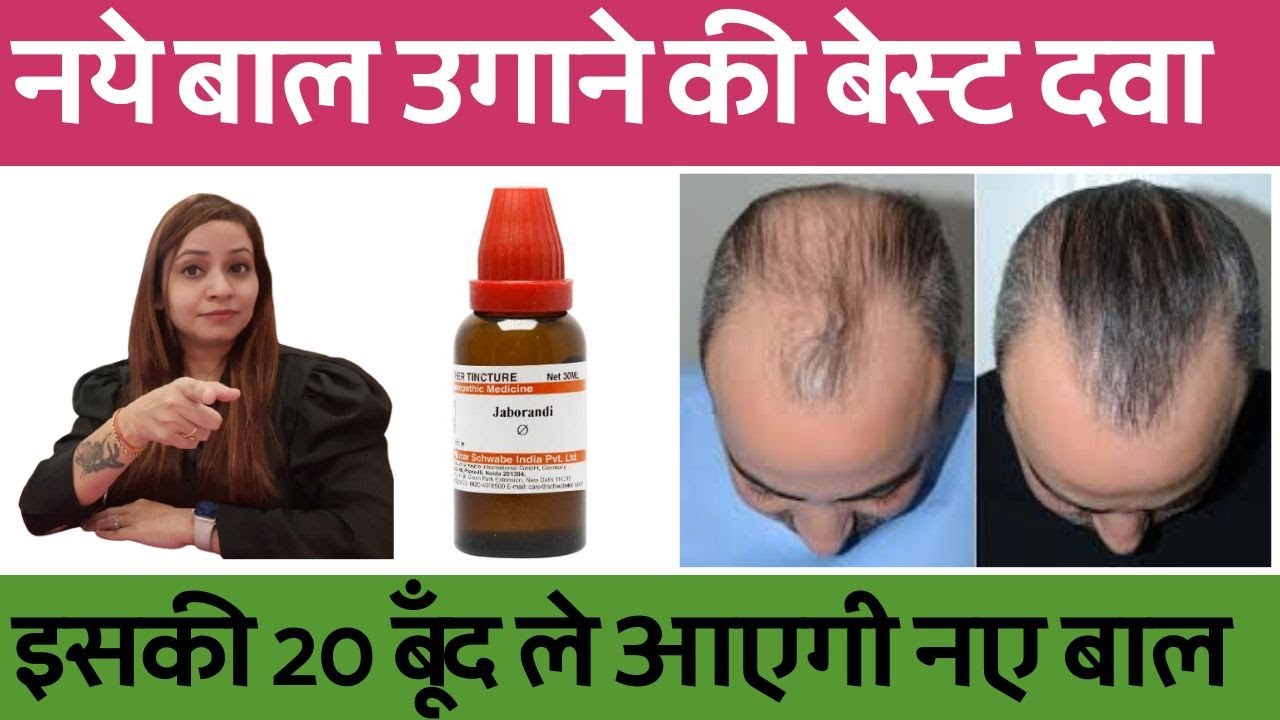 नये बाल उगाने के लिए बेस्ट होमियोपैथी दवा | hair growth homeopathy treatment and medicines