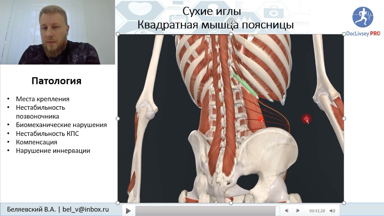 Иглоукалывание в квадратную мышцу поясницы