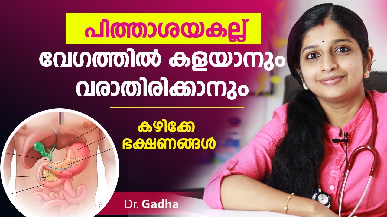 പിത്താശയ കല്ല് വേഗം മാറാൻ  |gallstones symptoms malayalam | Dr gadha |  pithashaya kallu malayalam