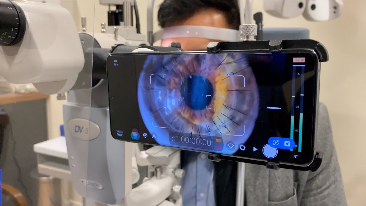 The best ophthalmic imaging using your phone