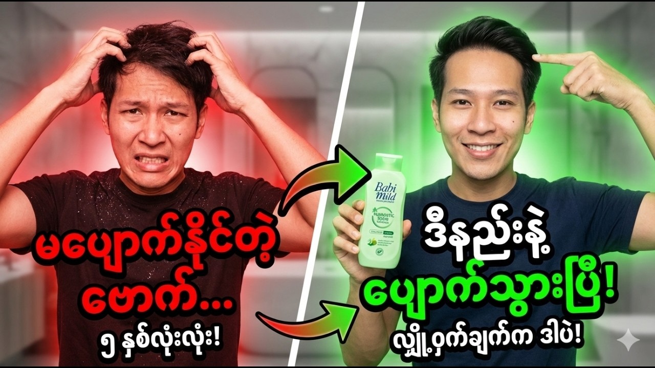 လွန်ခဲ့တဲ့ ၅ နှစ်က ကျွန်တော် မှားခဲ့ပါတယ် (ဗောက်ကုနည်း အမှန်)