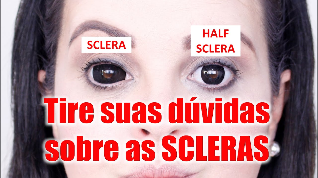 D&Uacute;VIDAS SOBRE LENTE SCLERA E HALF SCLERA