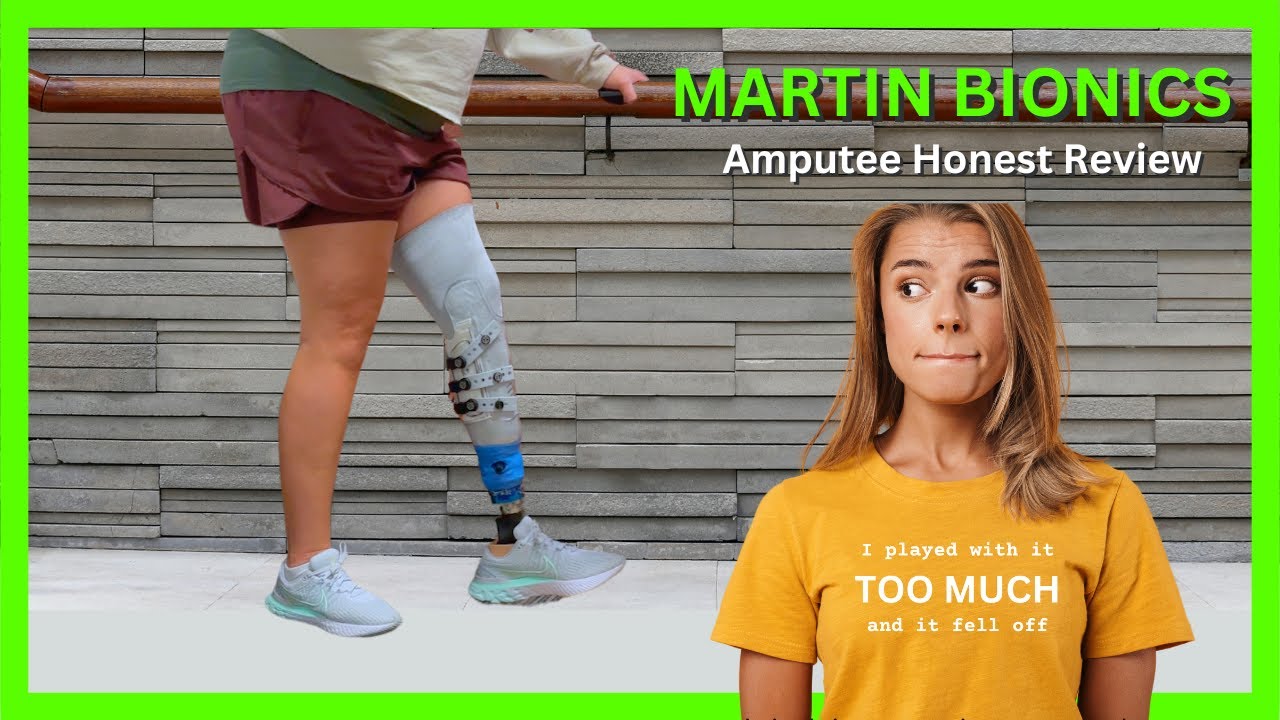 Martin Bionics Full Review | CAN YOU RETURN A PROSTHETIC LEG? Advocating for yourself as an amputee.