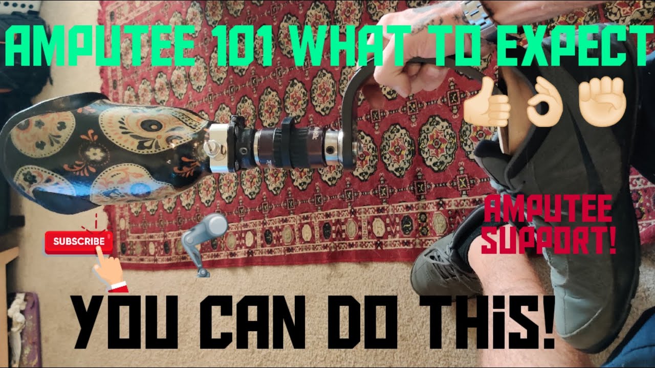 AMPUTEE 101 EPISODE 2! WHAT TO EXPECT (IMPORTANT INFORMATION) SAVE YOURSELF FROM THE STRESS N PAIN!!
