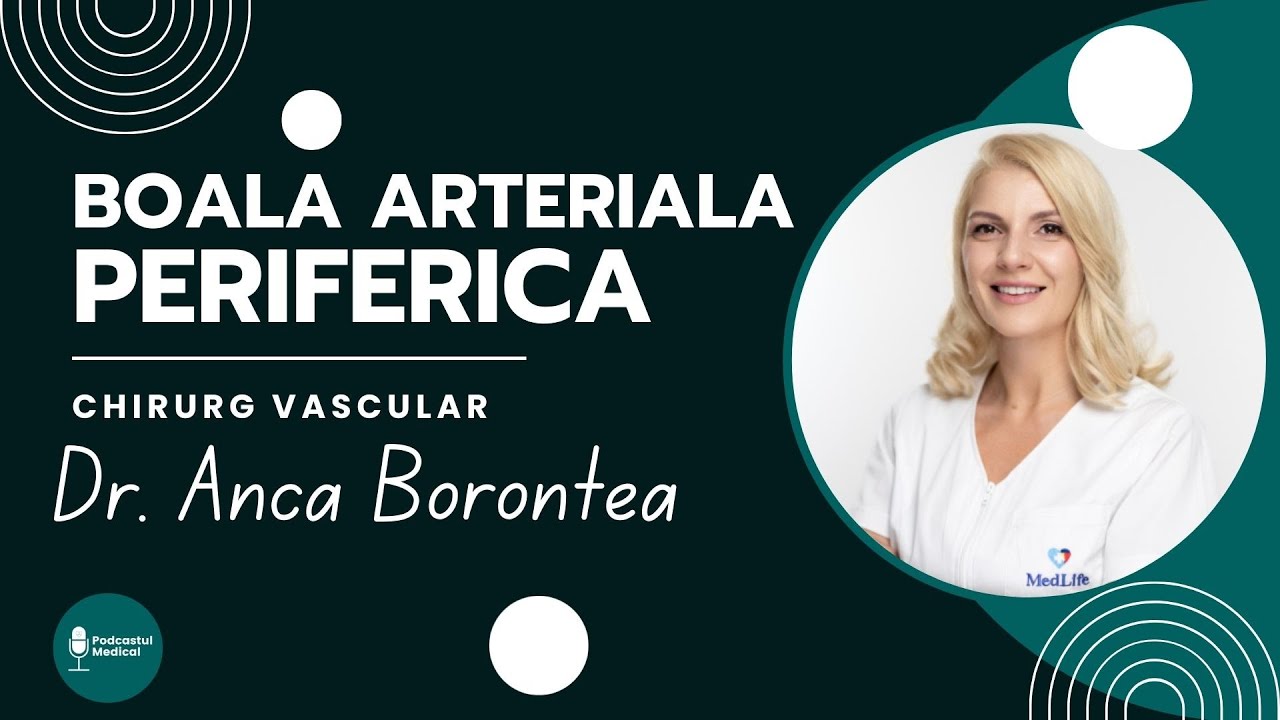 Boala arteriala periferica | Dr. Anca Borontea