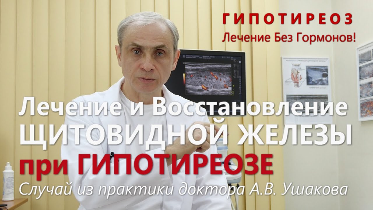 Гипотиреоз: Лечение без гормонов Щитовидной железы. Пример случая из практики || Доктор Ушаков