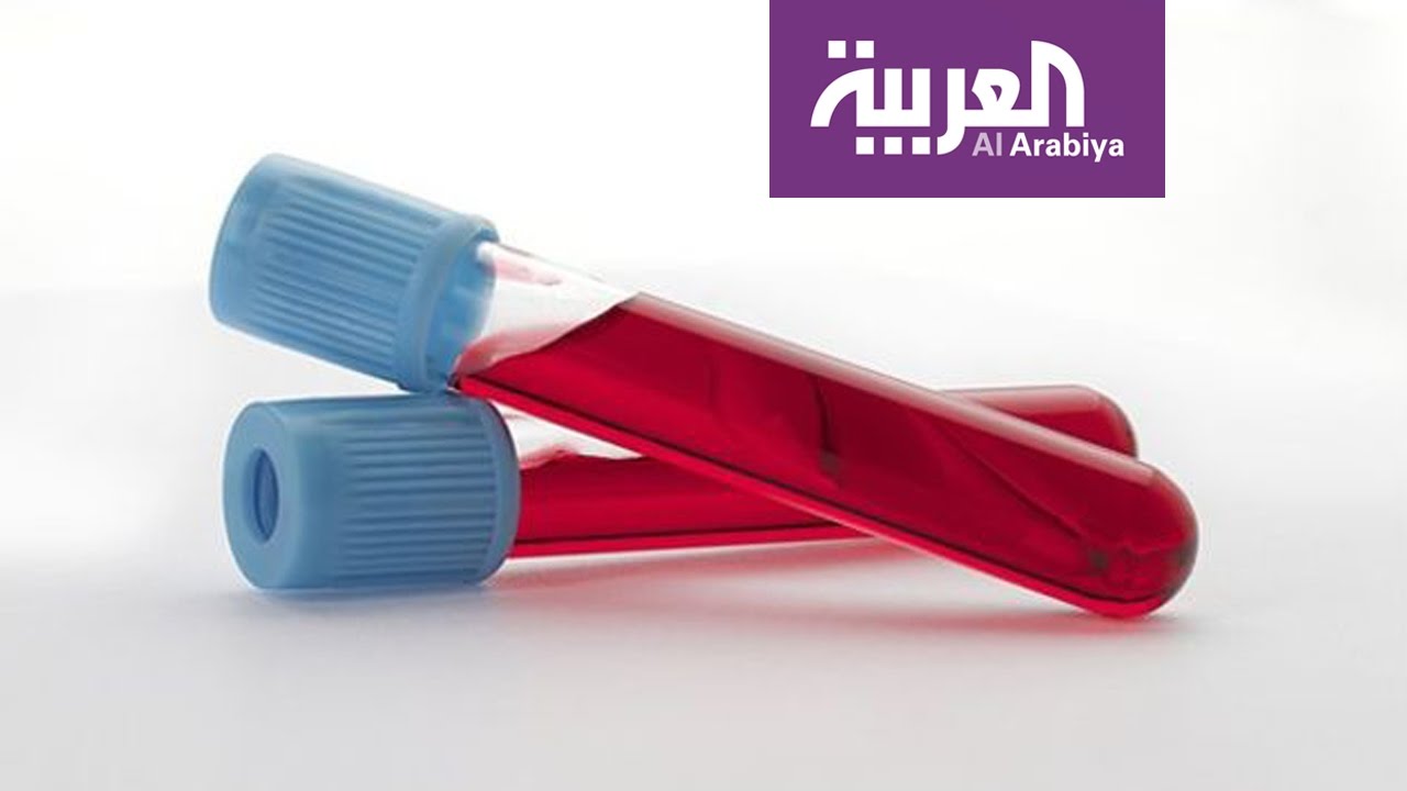 فحص دم يكشف التوحد