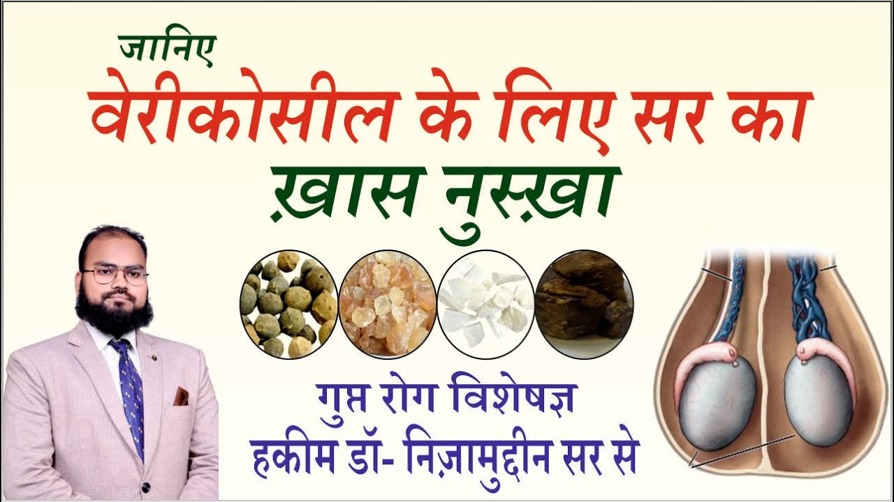 Best Varicocele Treatment by Infertility Specialist Dr. Nizamuddin - Must Watch!