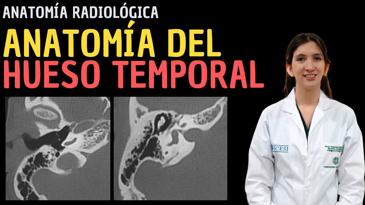Anatomía Radiológica: Anatomía del hueso temporal.