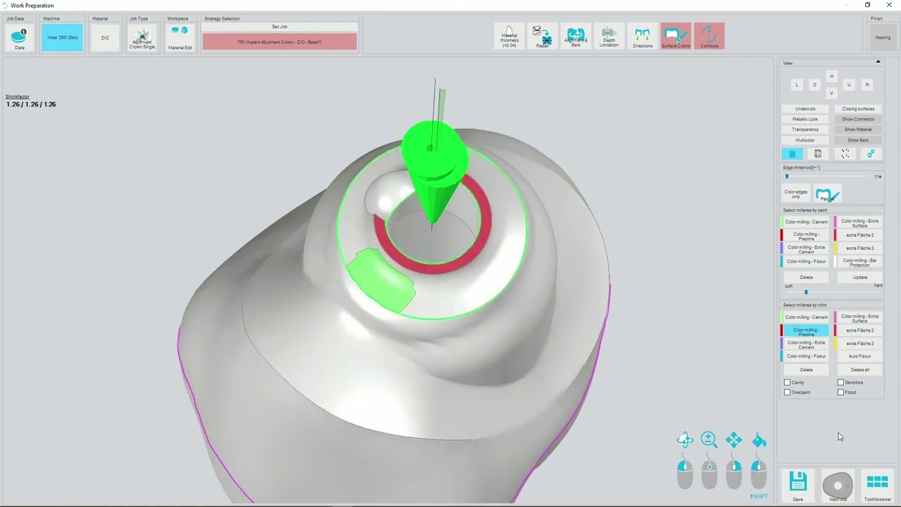 matrix&reg; CAM DentalSoftworks/PrograMill Workflow | matrix&reg; Digital Academy