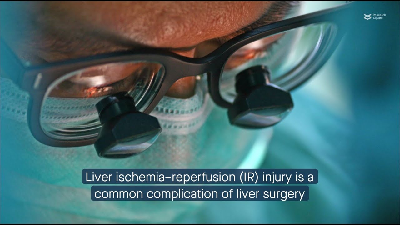 Caspase 6 mediates liver ischemia-reperfusion injury by promoting inflammation and cell death
