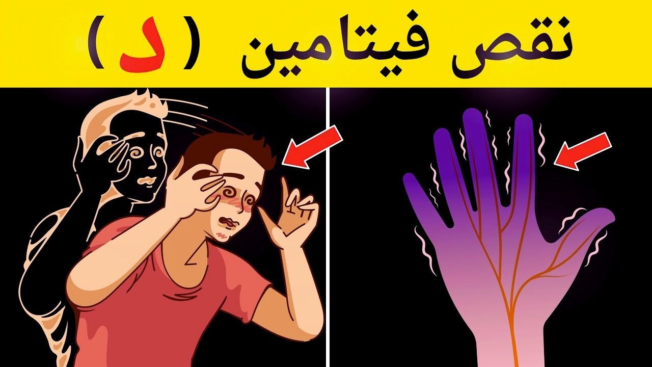 علامة تحذيرية أنك تعاني من نقص فيتامين د | لا تتجاهل هذه العلامات