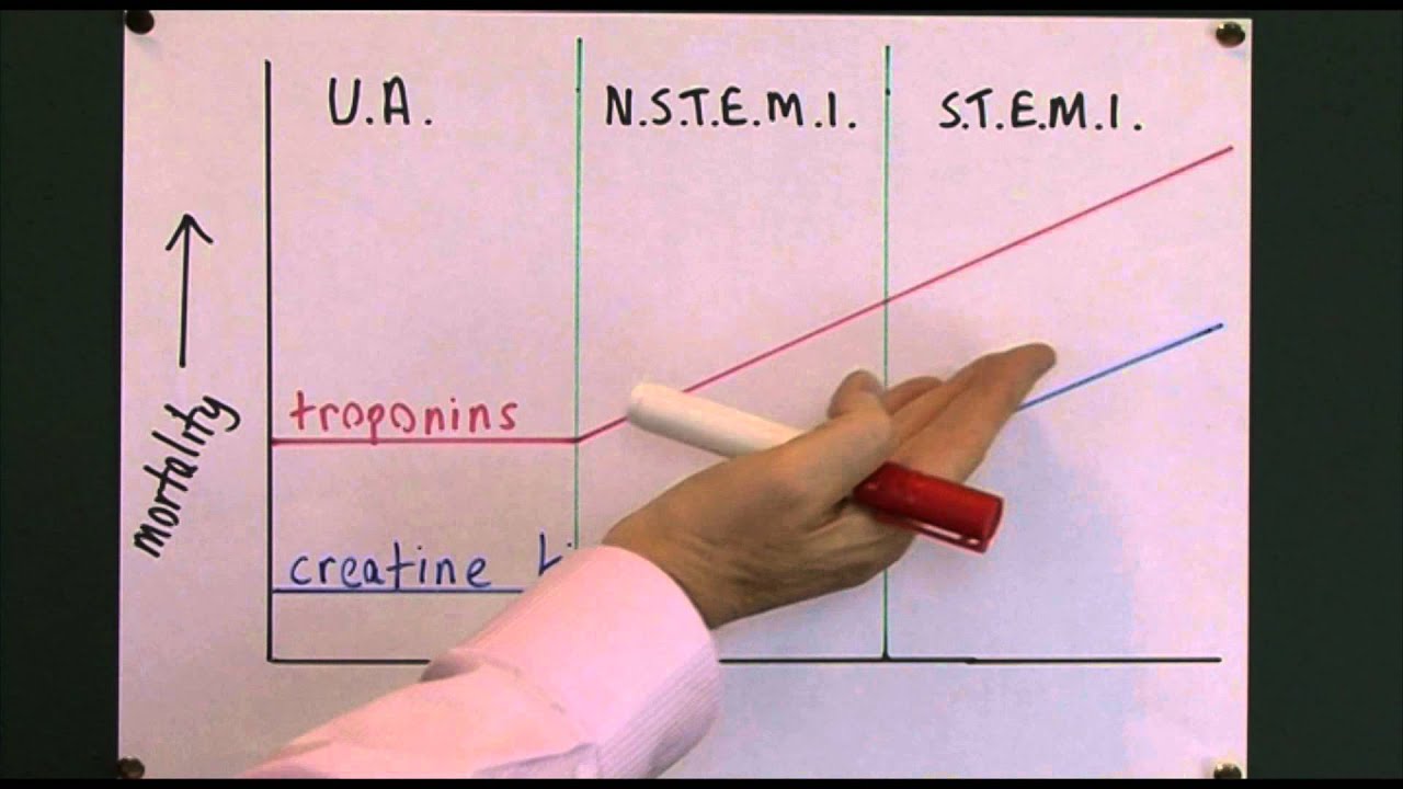 Heart disease 7, Cardiac markers