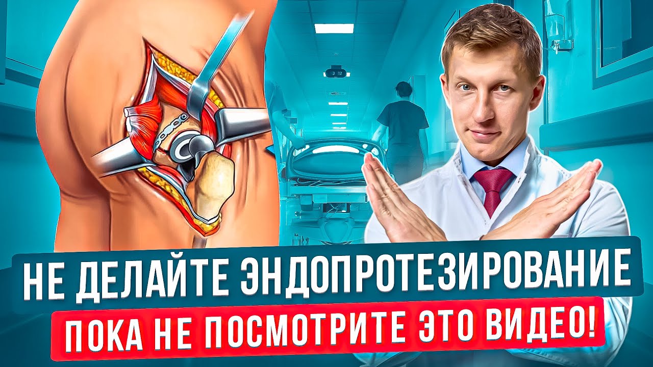 Вся правда об эндопротезировании тазобедренного сустава. Операция по замене тазобедренного сустава.