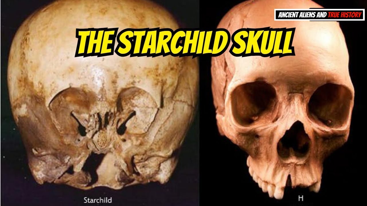 The Starchild Skull &ndash; A Discovery Of Alien Ancestors