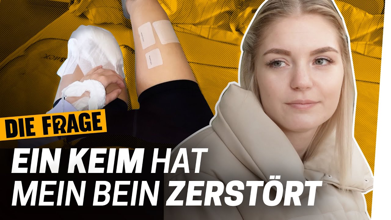Amputation: 33 Operationen konnten mein Bein nicht retten | Wie komme ich mit meinem Körper klar? #6
