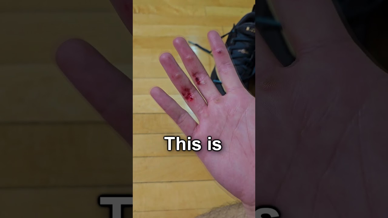 Problems only Basketball Players have 😫🤕