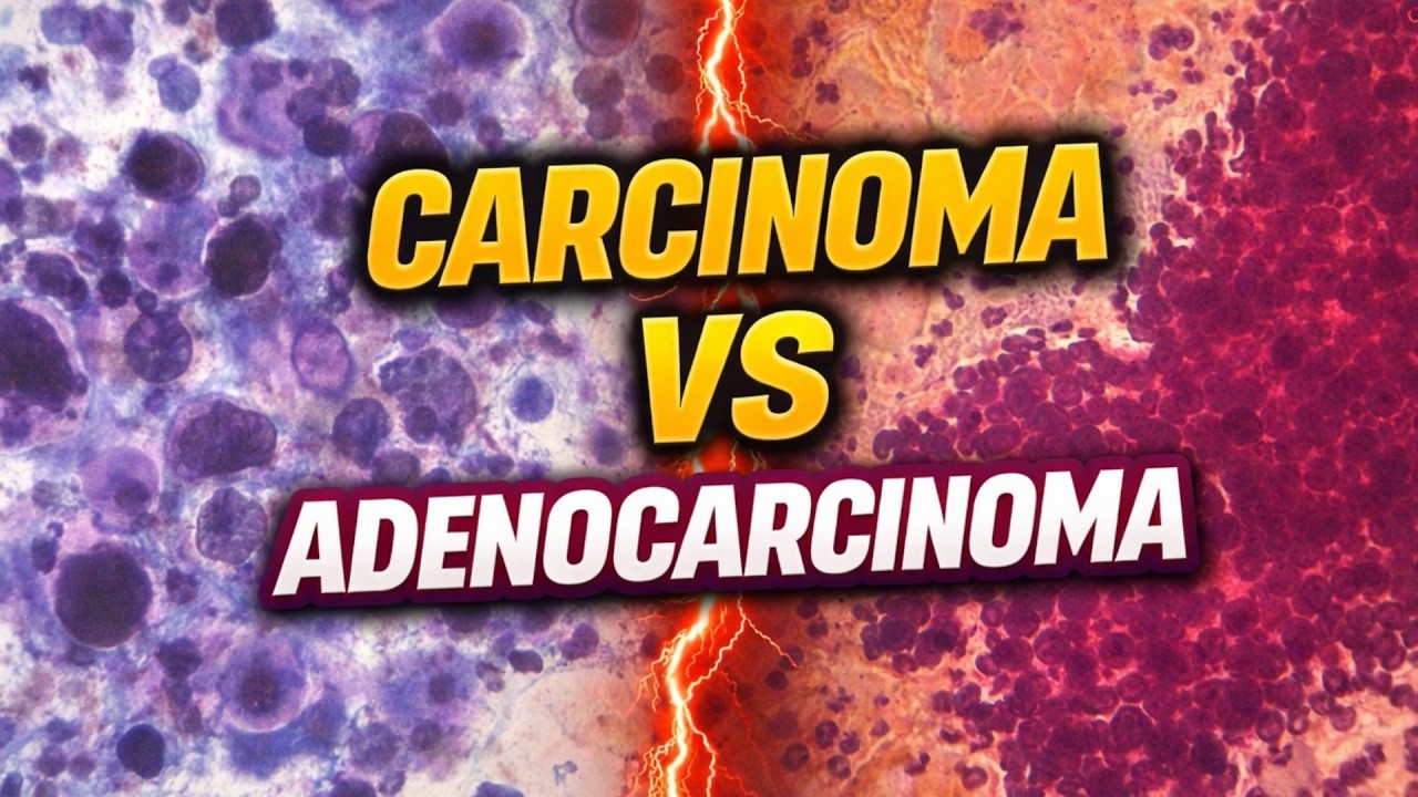 Carcinoma Vs Adenocarcinoma