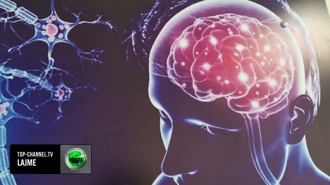 Top Channel/ Epilepsia e shërueshme, mjekët: Mos e fshihni këtë sëmundje, pasojat janë fatale