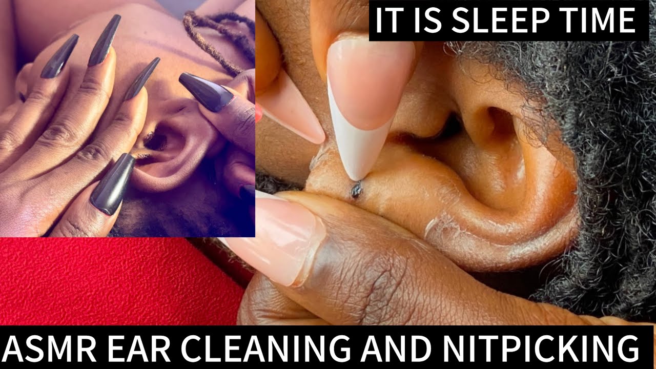 ASMR EAR CLEANING VERY SATISFYING FOR THOSE WHO NEED QUICK SLEEP WITH GUM CHEWING @AsmrbyBecserah