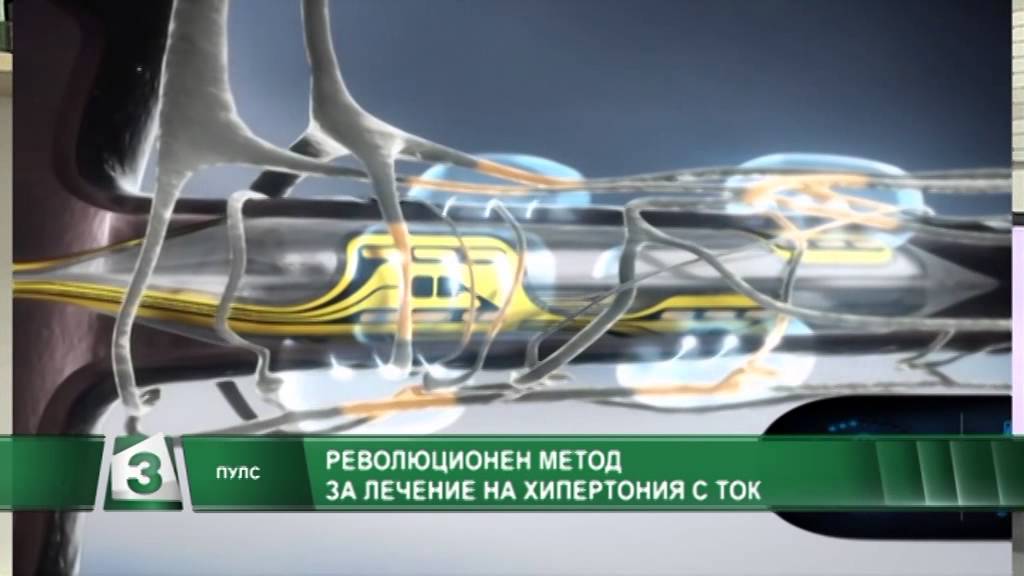 Ренална денервация в МБАЛ 