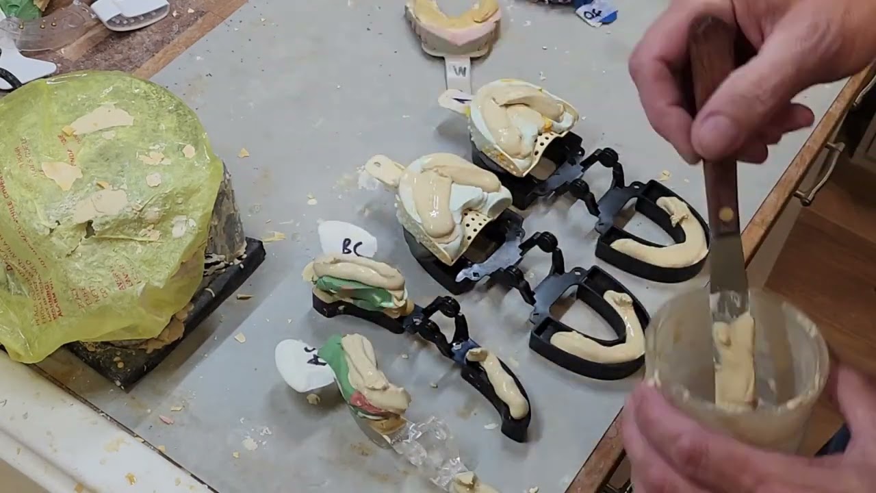 Black Diamond Dental Model Articualtor System Instructional Video for Stone Models. Fast & Accurate.