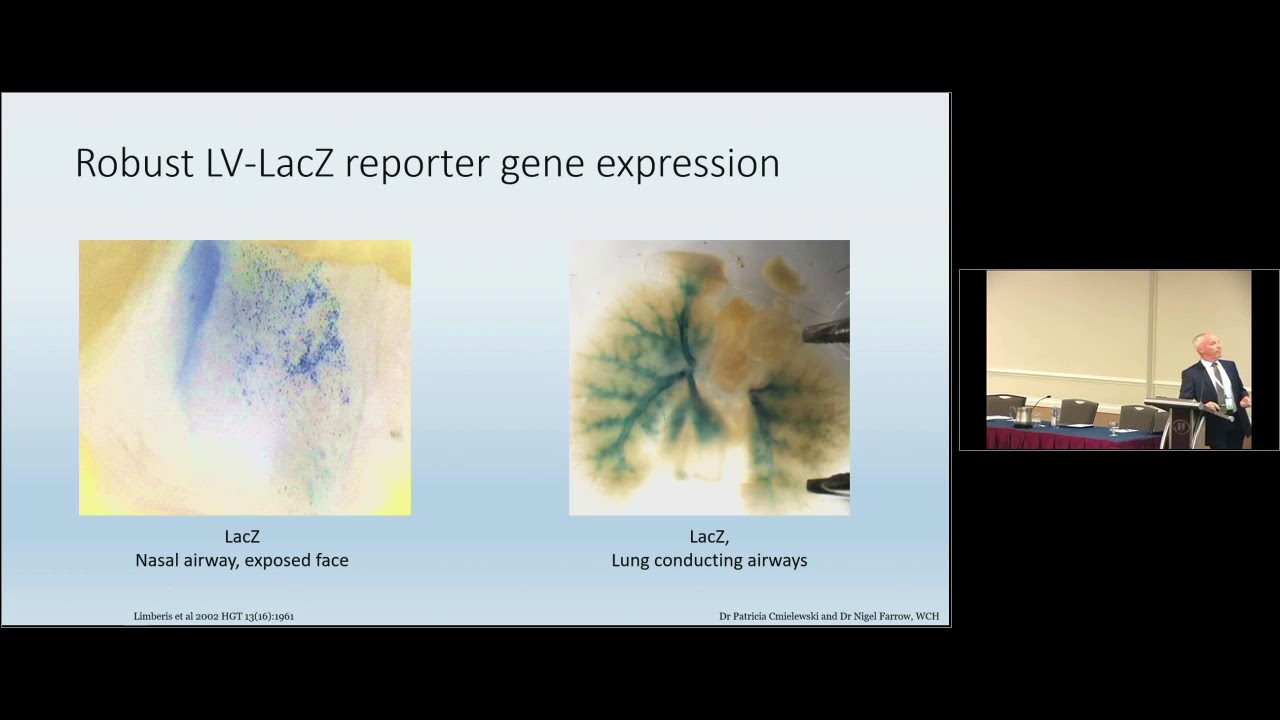 Lentivirus-mediated Gene Transfer in Stem Cells for Correction of Cystic Fibrosis Defect in Airway