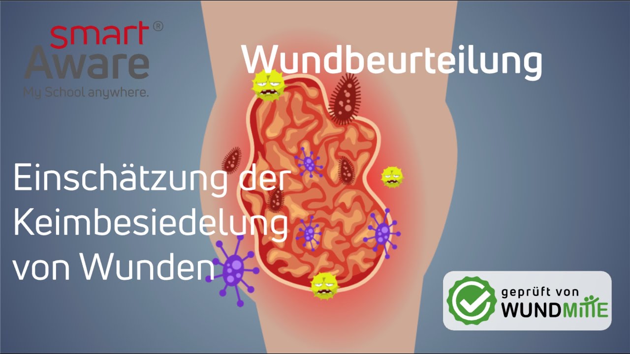 Wundbeurteilung | Einschätzung der Keimbesiedelung | Wundmanagement in der Pflege