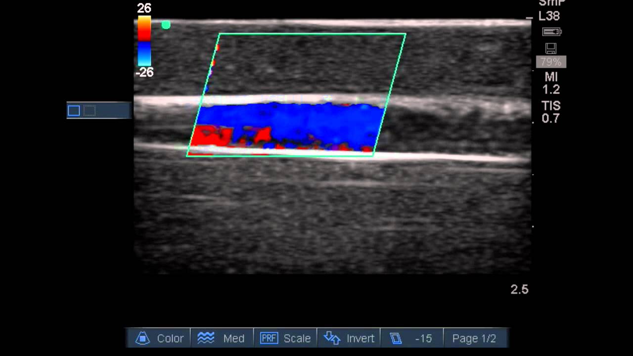 Peripheral Doppler Ultrasound Training Model