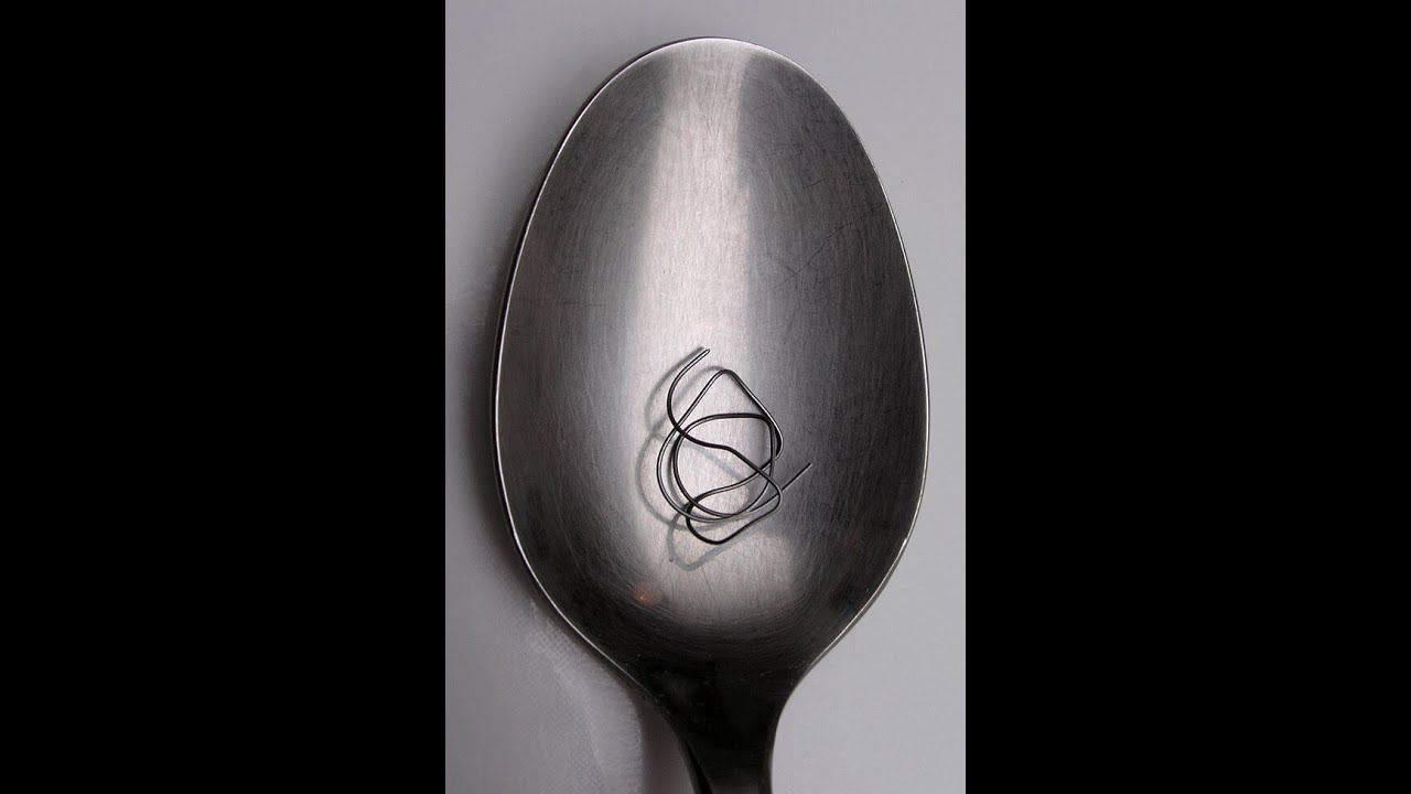 Nitinol - orthopaedics -MS exam - Recent advances orthopedics