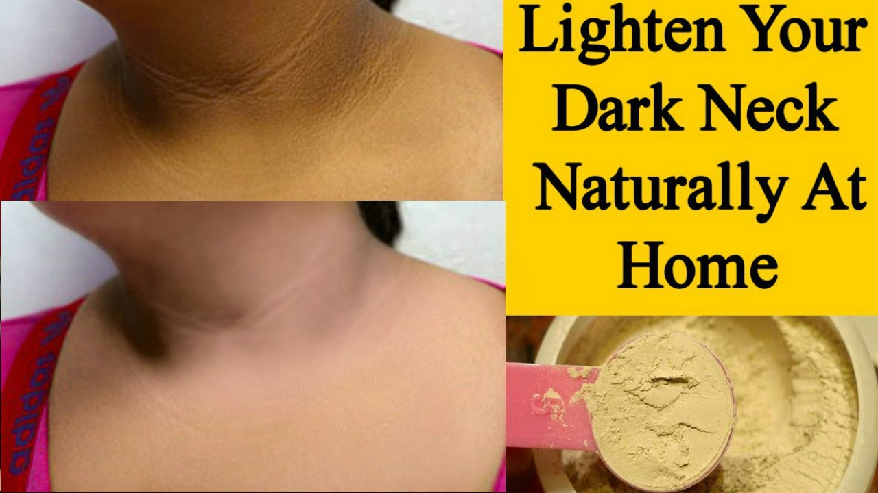 Skin Whitening For Dark Neck - Dark Neck Home Remedy *Simple Beauty Secrets*