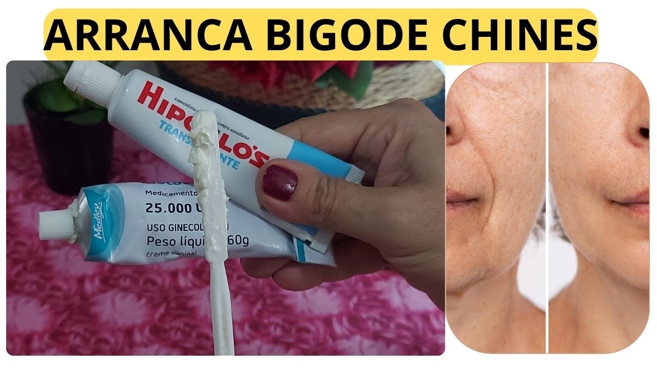 DESSAMASSA ROSTO! AS RUGAS PROFUNDAS NÃO RESISTEM