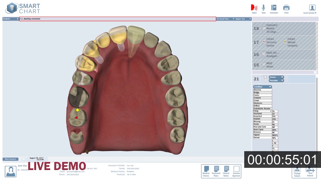 SmartChart&trade; - 3D Odontogram Demo