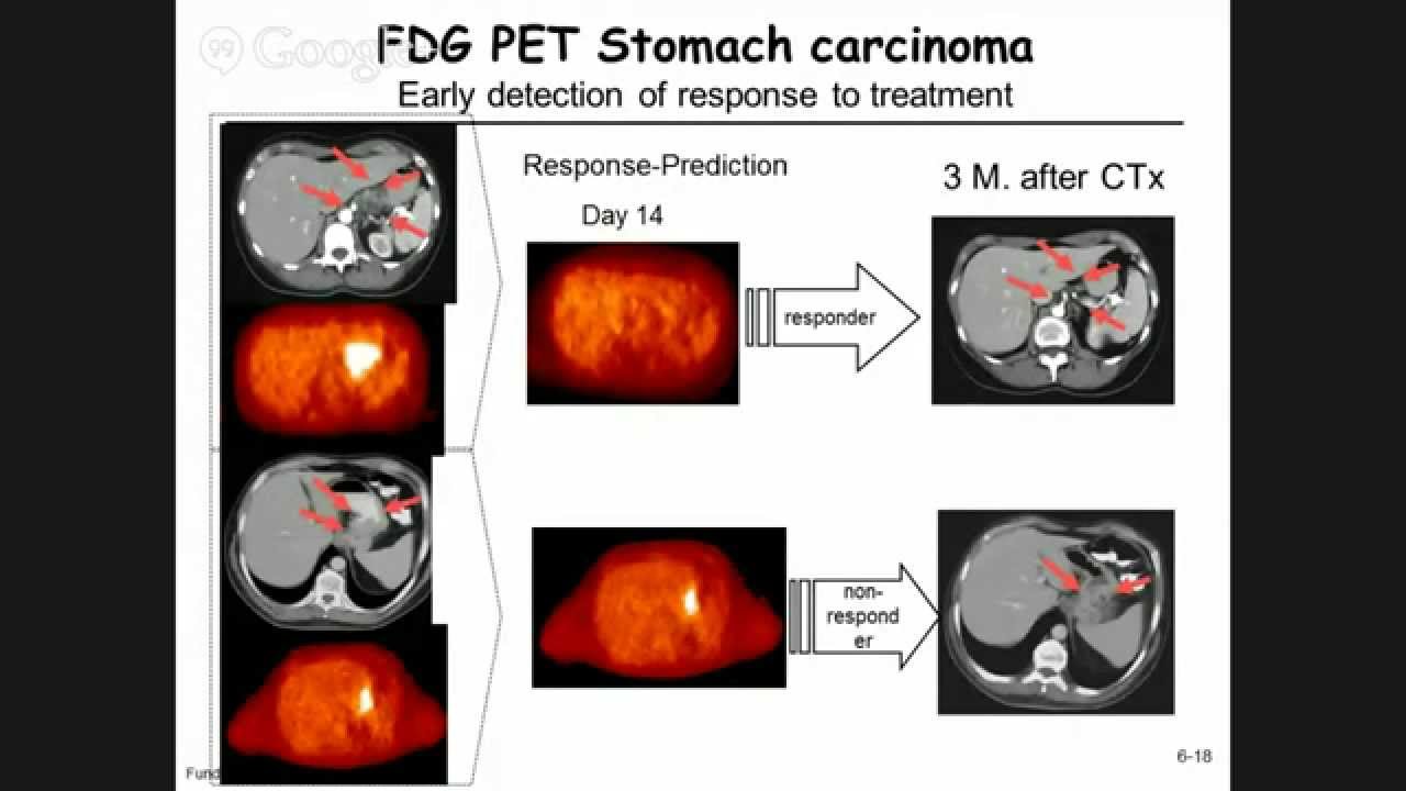 6.2 - Positron emission tomography : attenuation and resolution