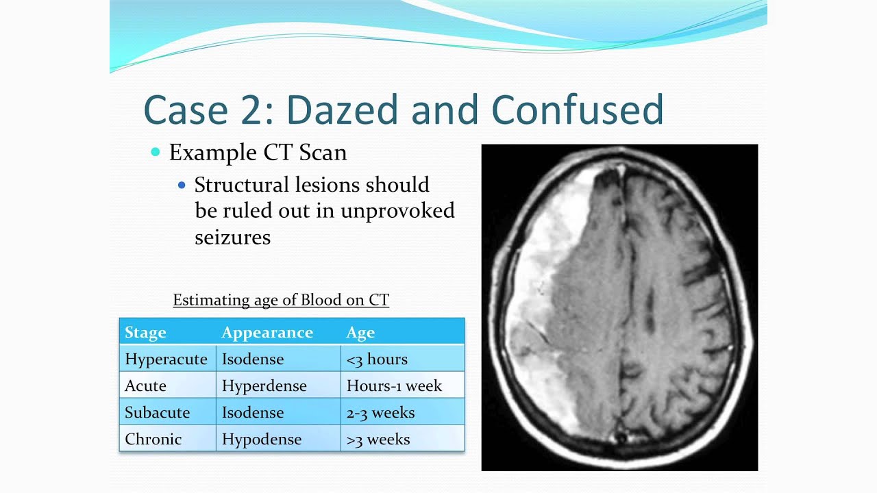 Hormozd Bozorgchami, M.D. - Stroke Mimics & Stroke Ciphers