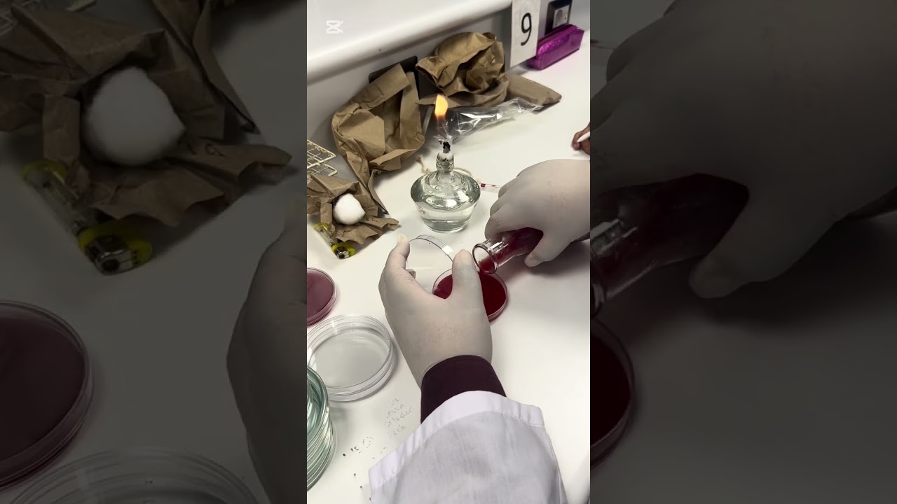 Agar sangre y chocolate (bacteriología) 