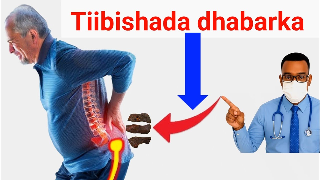 Calaamadaha Tiibishada lafaha, dhabarka iyo kala Gooys-yada jirka ( skeletal TB )