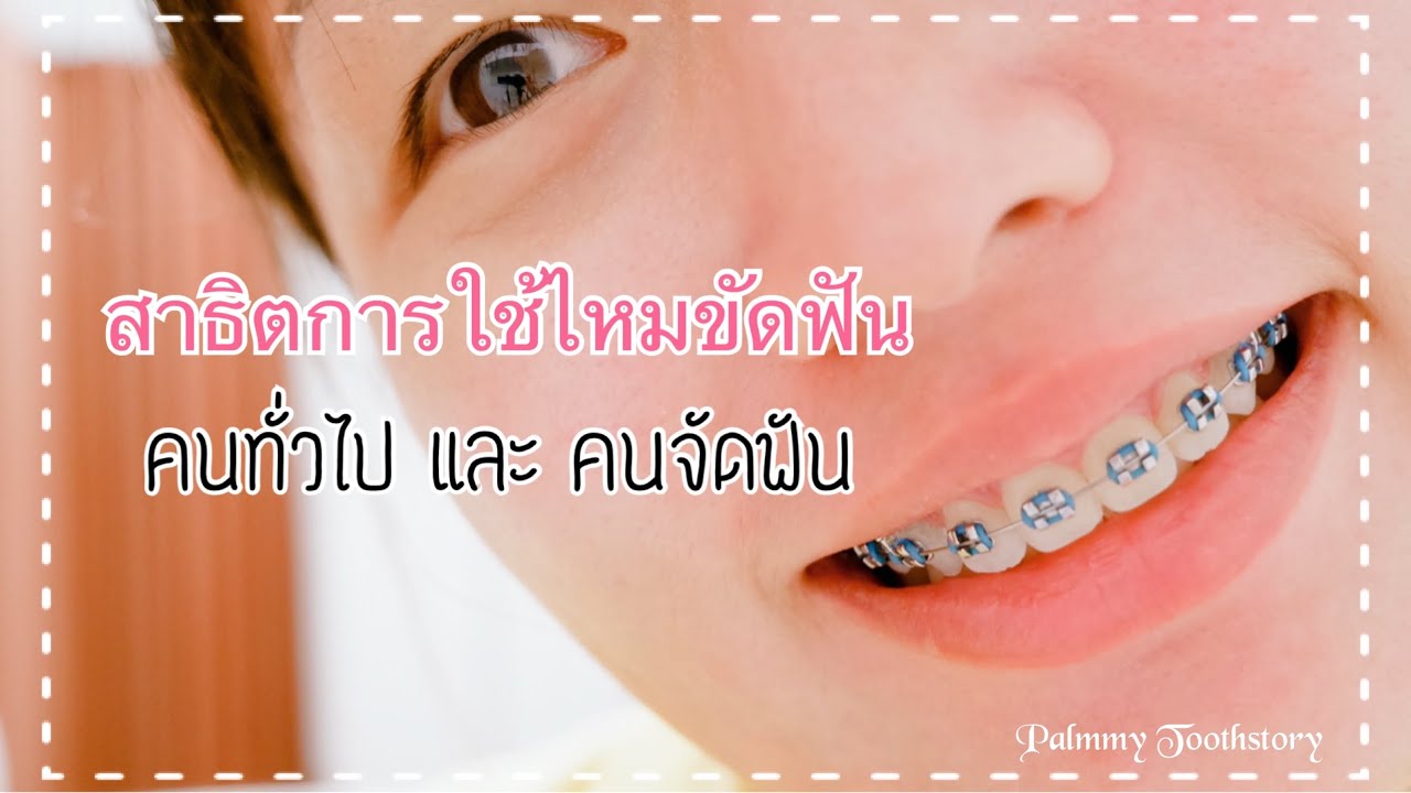สาธิตการใช้ไหมขัดฟัน คนทั่วไปและคนจัดฟัน