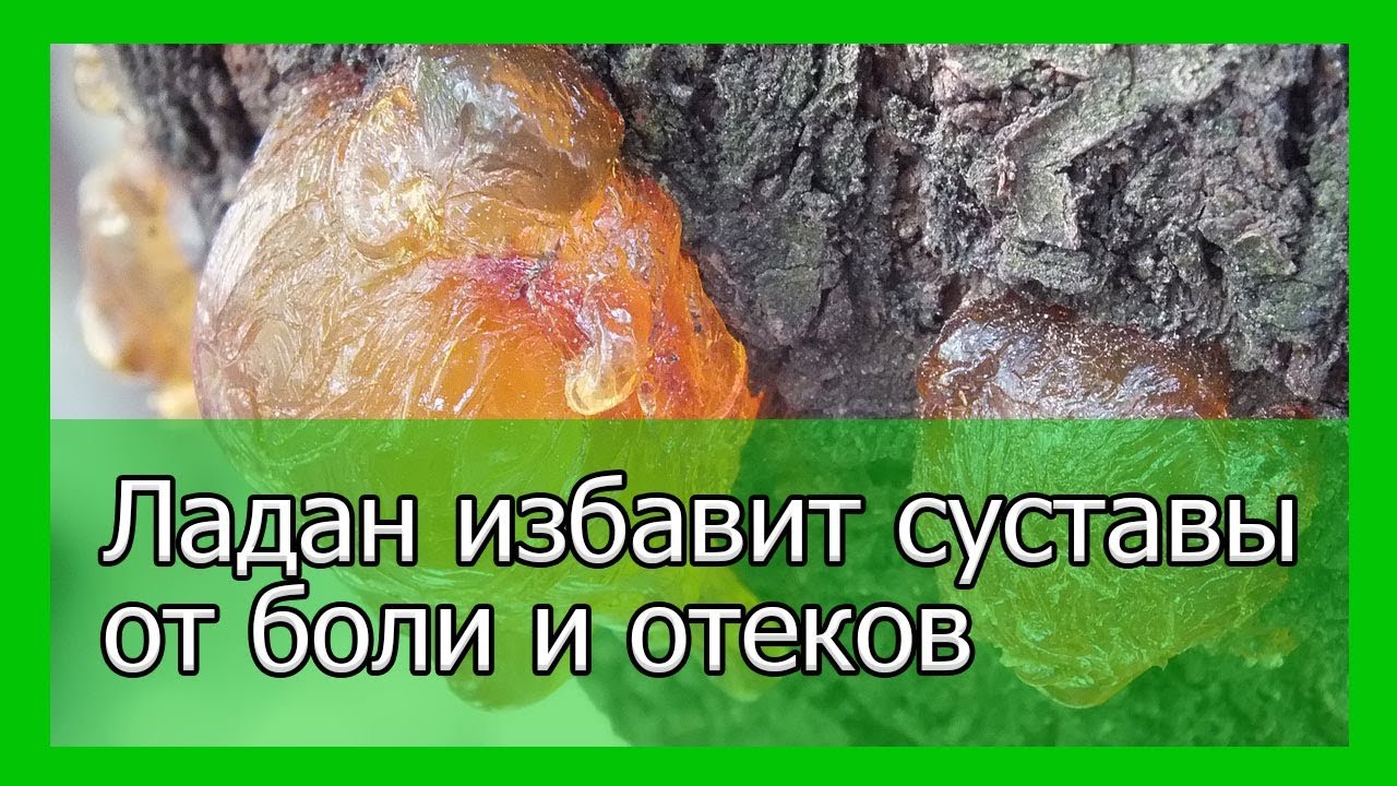 Ладан избавит суставы от боли и отеков