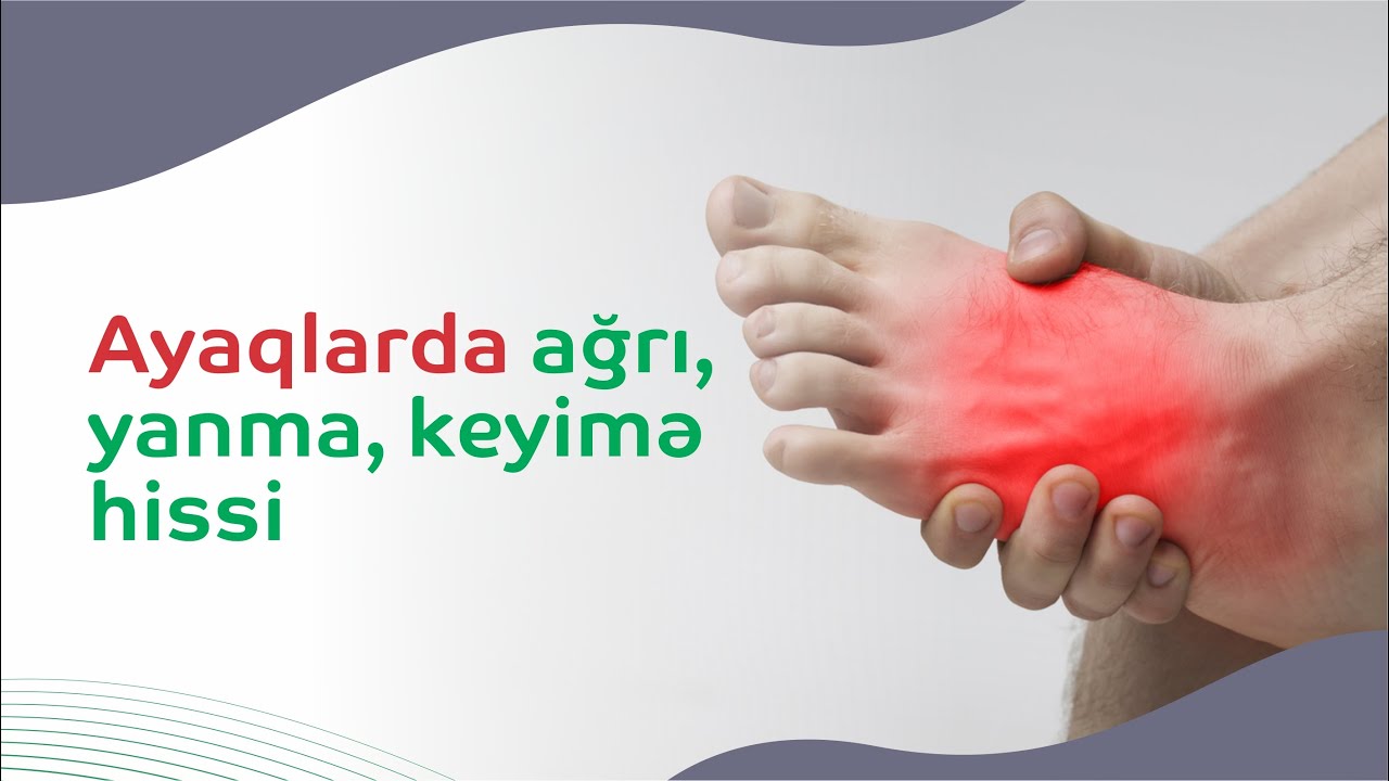 Ayaqlarda ağrı, yanma, keyimə hissi - Səbəbi bunlar ola bilər...