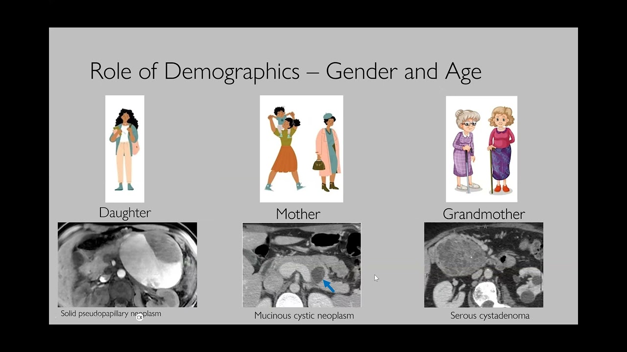 KREST WEBINARS : IMAGING IN CYSTIC LESIONS OF PANCREAS, Dr ANIL.K DASYAM, USA