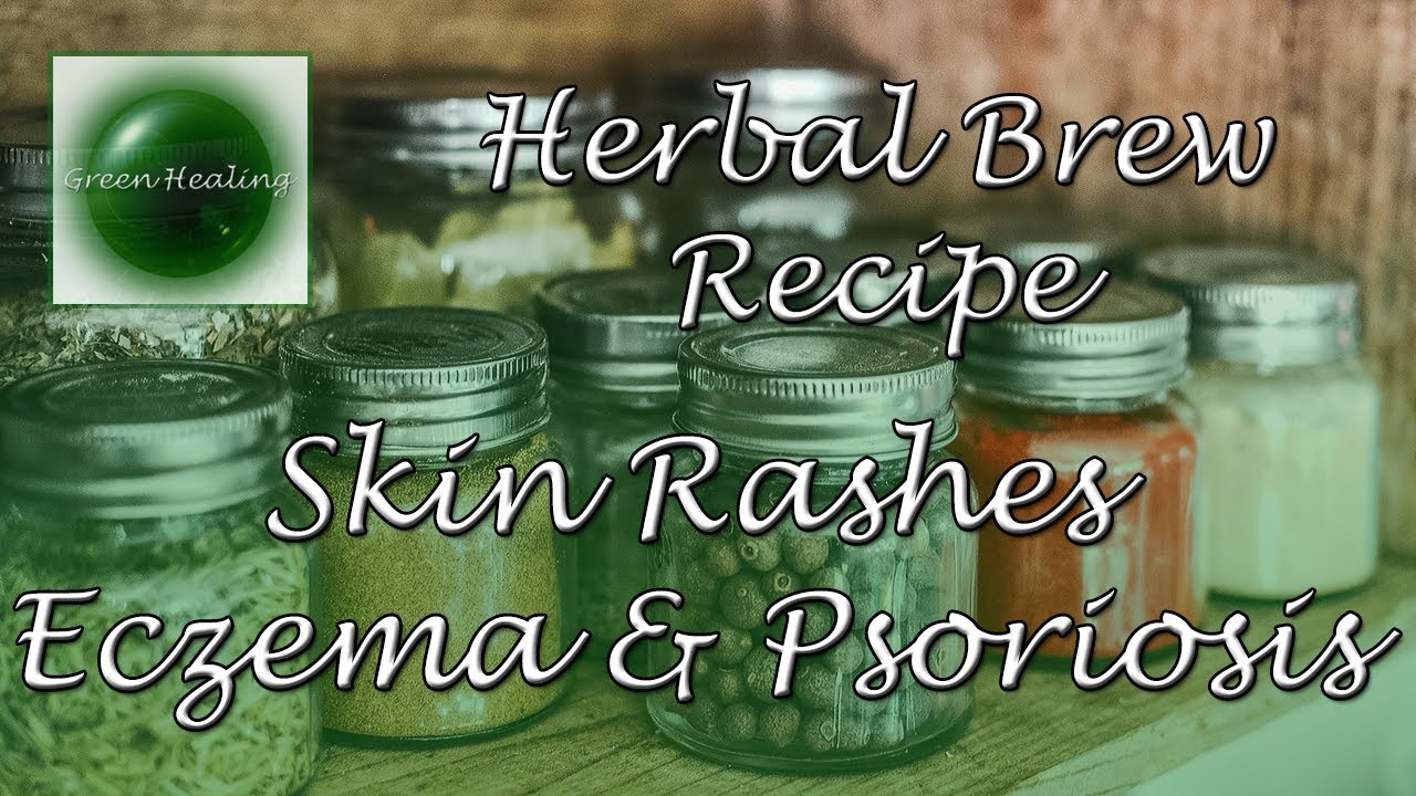Brew Herbs for Skin Rashes, Eczema, Psoriasis - Natural Healing (Green Healing S4E19)
