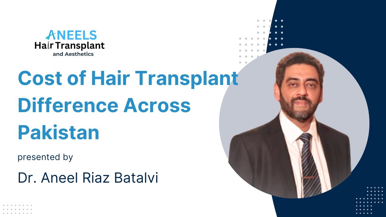 Cost of Hair Transplant Difference Across Pakistan | Dr. Aneel Vlog