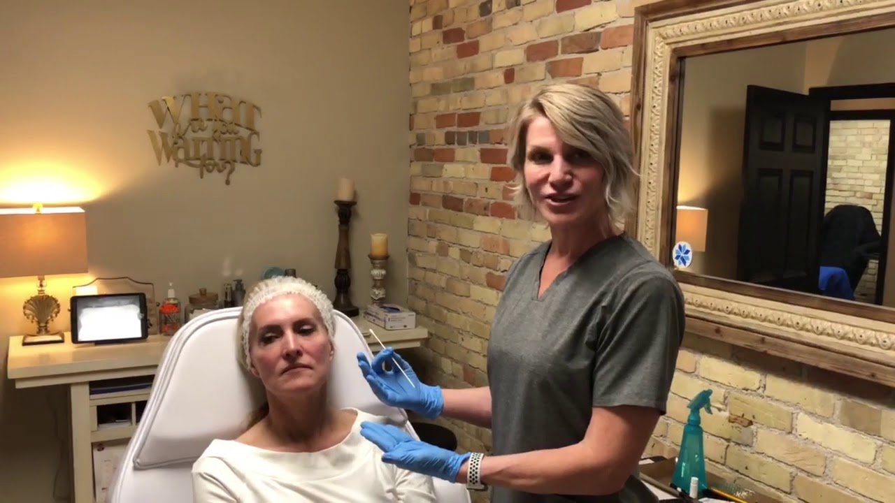 Tondue Filler Demo