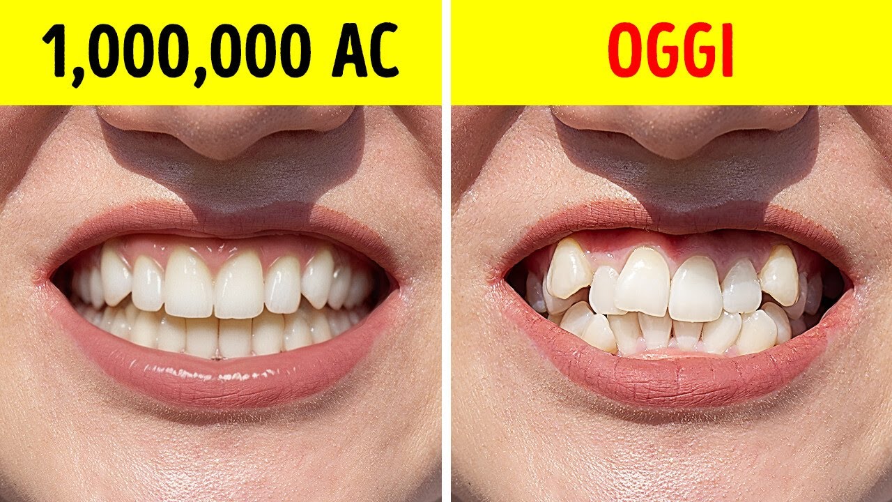 Perch&eacute; gli Uomini Primitivi Avevano i Denti Perfettamente Dritti