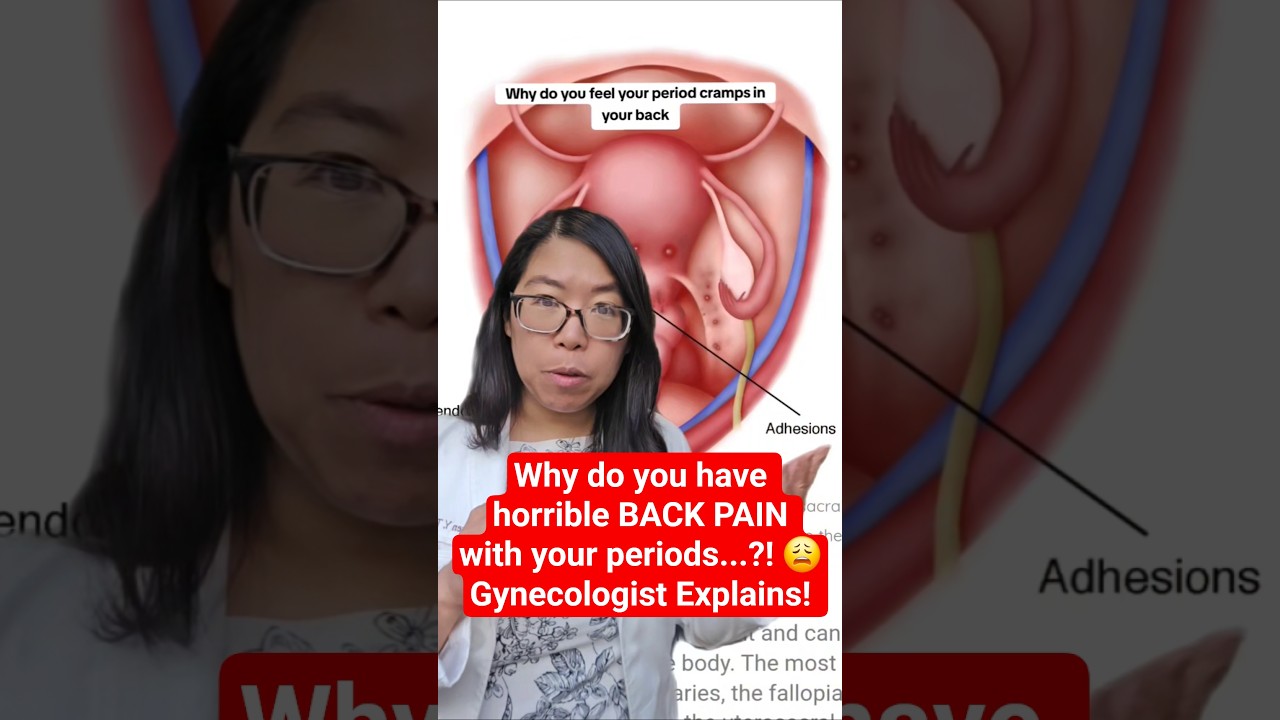 Why does your BACK hurt so much with your periods?! Gynecologist Explains! #shorts #endometriosis