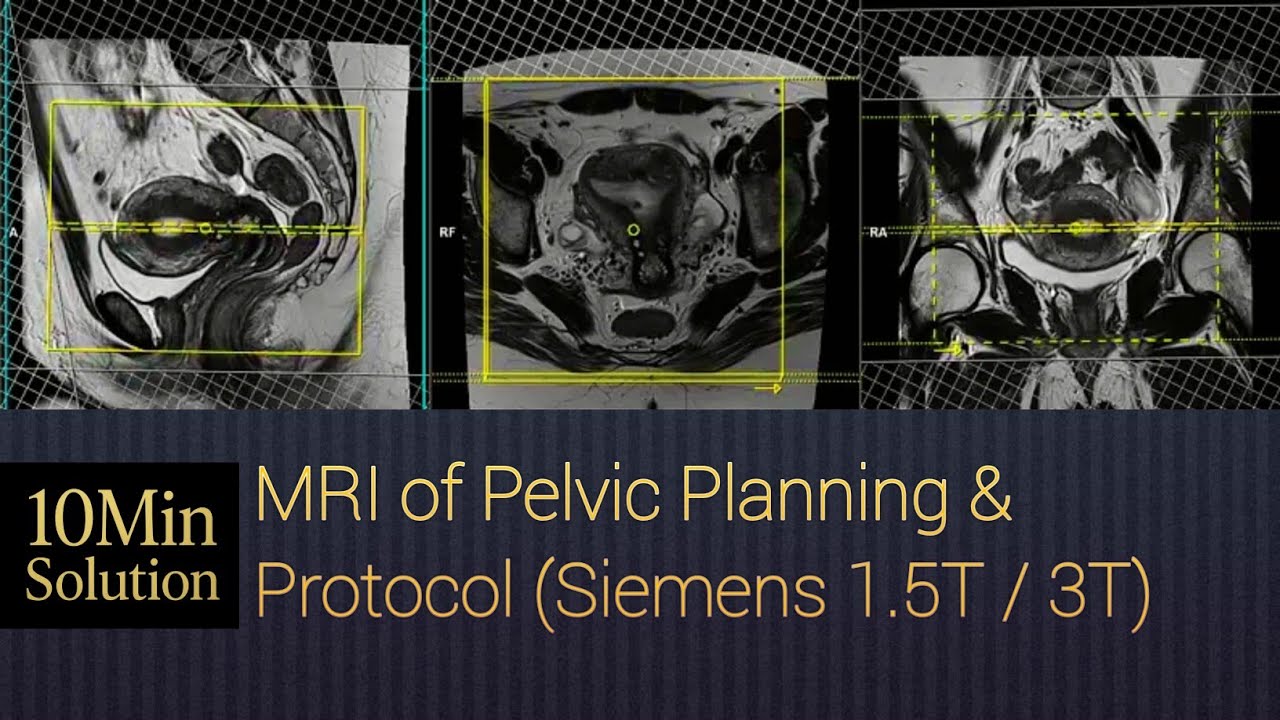 How to MRI of Pelvis | Positioning & Planning Tutorial
