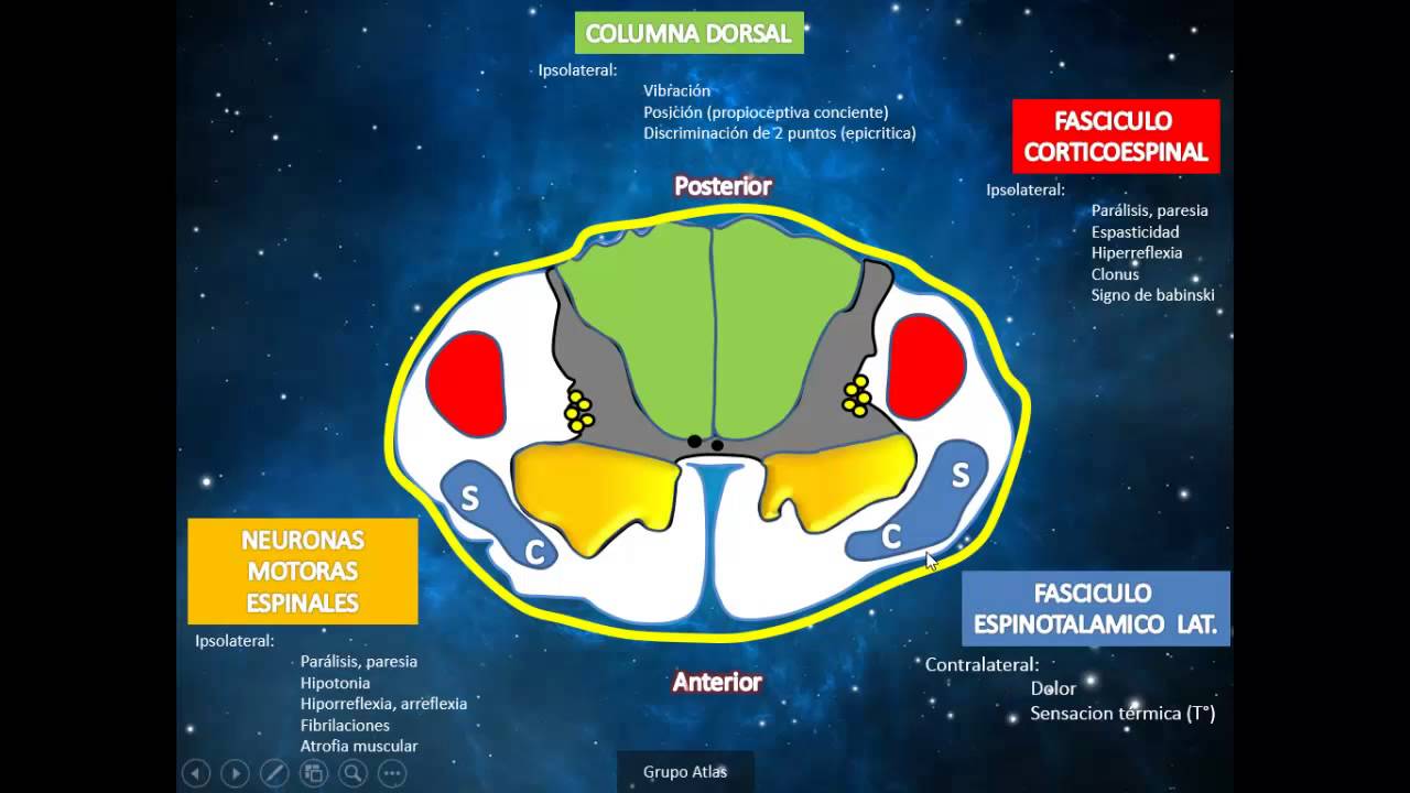 SINDROMES MEDULARES - REVISION ANATÓMICA - SEMIOLÓGICA