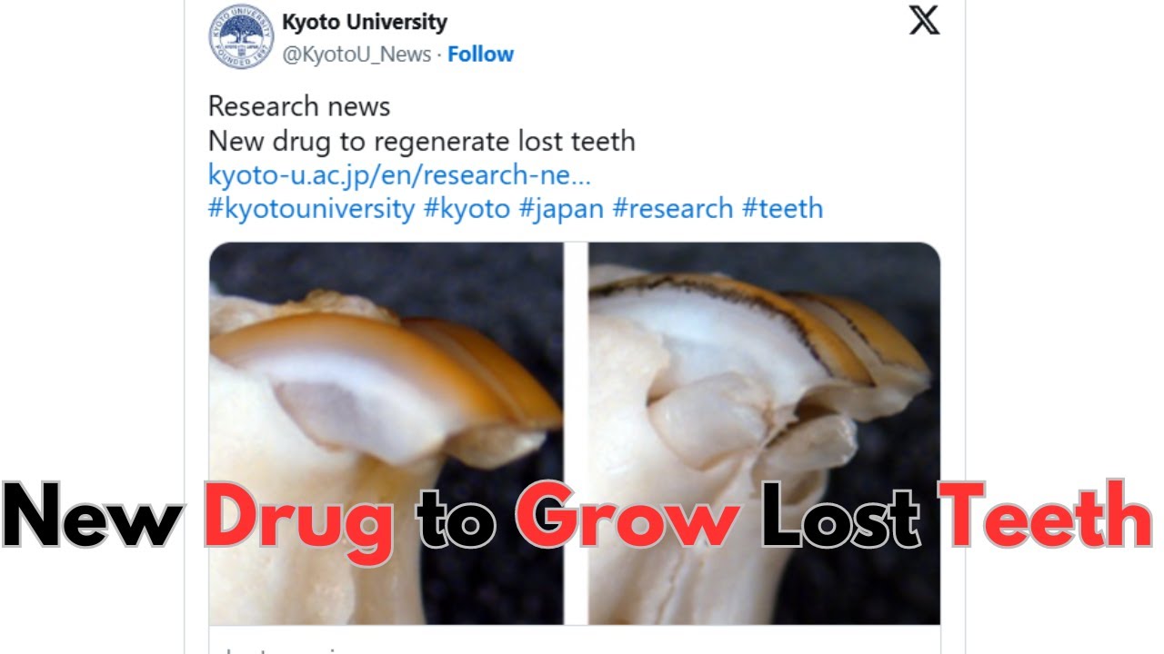 Tooth Regrowing Drug Coming 2030