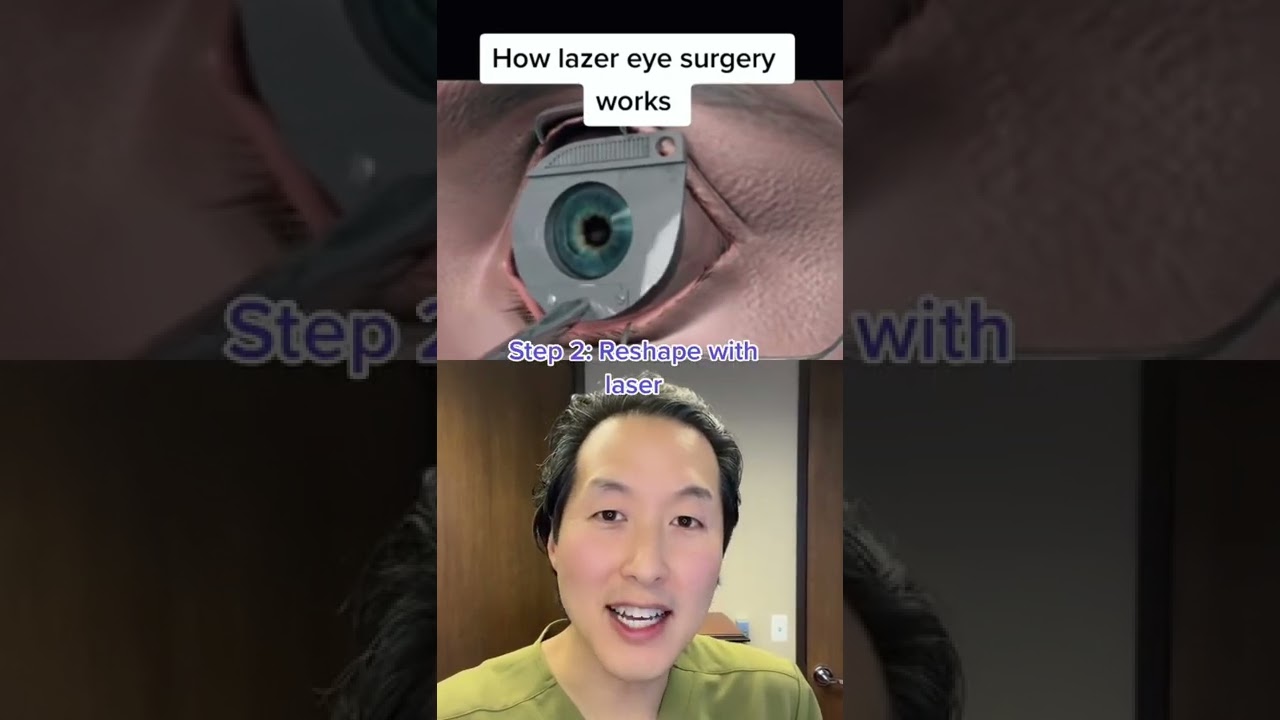 Как работает лазерная коррекция зрения LASIK! #shorts #lasik #lasereyesurgery